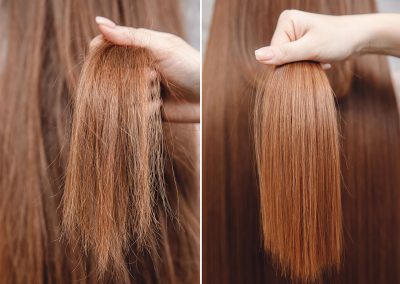 Trattamenti per lo stelo